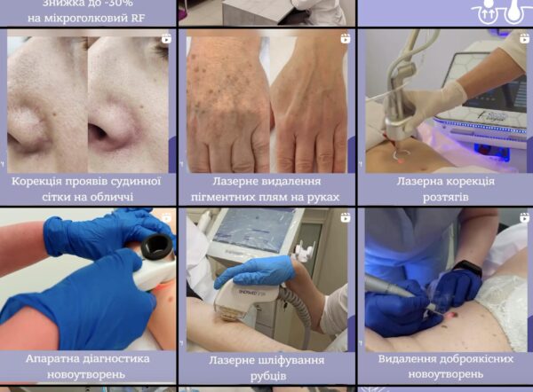 Instagram publique example