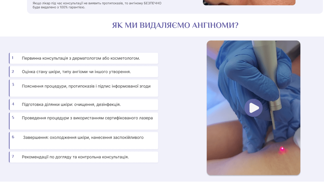 Вигляд етапу робіт ПК
