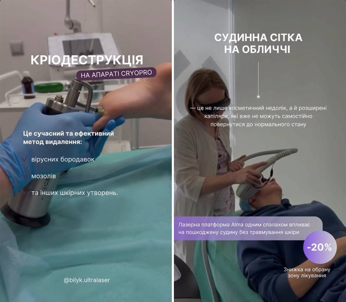 View stories AFTER